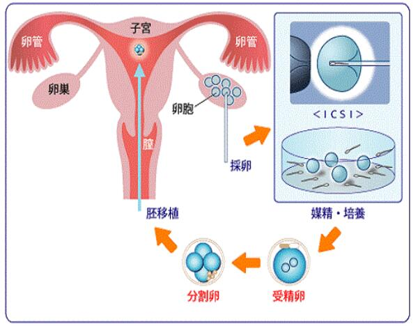 好的心态是泰国试管婴儿成功的关键